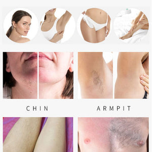 2000W Double Handle 808nm Diode Laser Hair Removal Machine