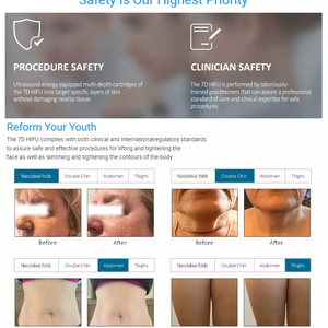 2 In 1 7D HIFU Facial Lifting Device With 10 Cartridges