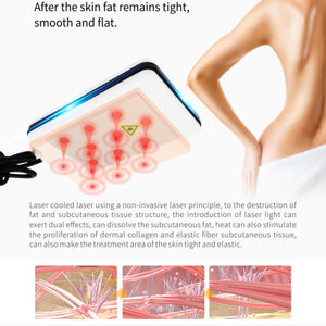 Portable 360 degree cryolipolysis fat freezing body slimming machine