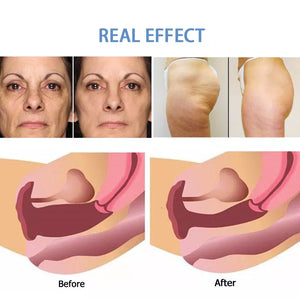 2 in 1 6D HIFU Body Face Lifting And Private Head Device