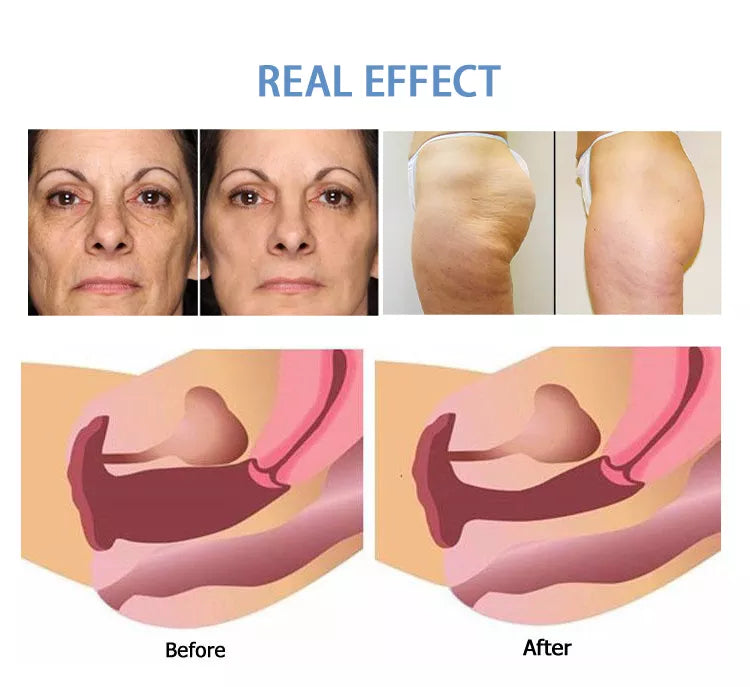 2 in 1 6D HIFU Body Face Lifting And Private Head Device