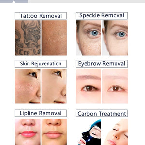 4 In 1 360 Magneto Opt For Hair Removal Skin And Tattoo Removal Machine