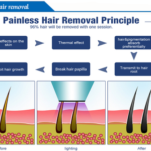 3 In 1 Professional  painless OPT IPL Vertical Hair Removal Machine