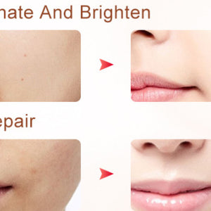 3 In 1 IPL Hair Removal Skin Rejuvenation Whitening Machine