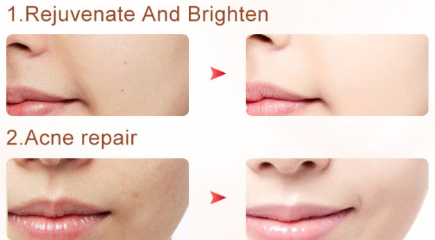 3 In 1 IPL Hair Removal Skin Rejuvenation Whitening Machine