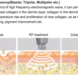 Professional Alien RF 80k /40k Ultrasound Cavitation Body Slimming Machine
