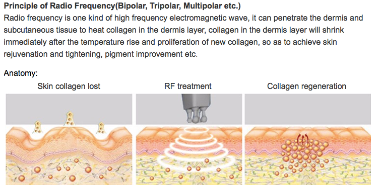 5D Cavitation Vacuum Body Slimming Machine