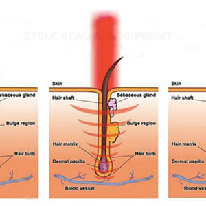 Laser pdt light therapy/anti-hair loss and skin rejuvenation machine