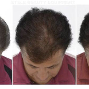 Laser pdt light therapy/anti-hair loss and skin rejuvenation machine