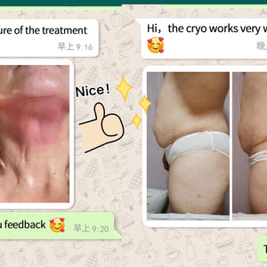 Professional Vertical Cryolipolysis Machine with 4  handles