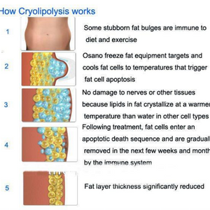 Portable 360 degree cryolipolysis fat freezing body slimming machine