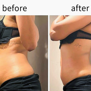 Professional Cryolipolysis Machine 5 Handles  360 Body Contouring Machine